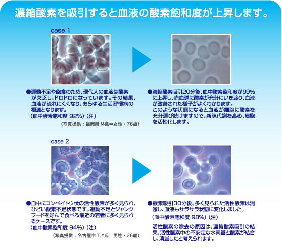 90％酸素発生器AJ300