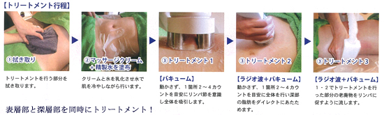 サーマスタープラス トリートメント行程