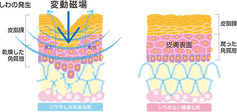 シワやしみのある肌と健康な肌との比較