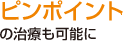 ピンポイントの治療も可能に