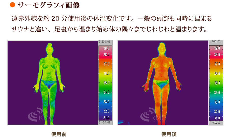 サーモグラフィ画像