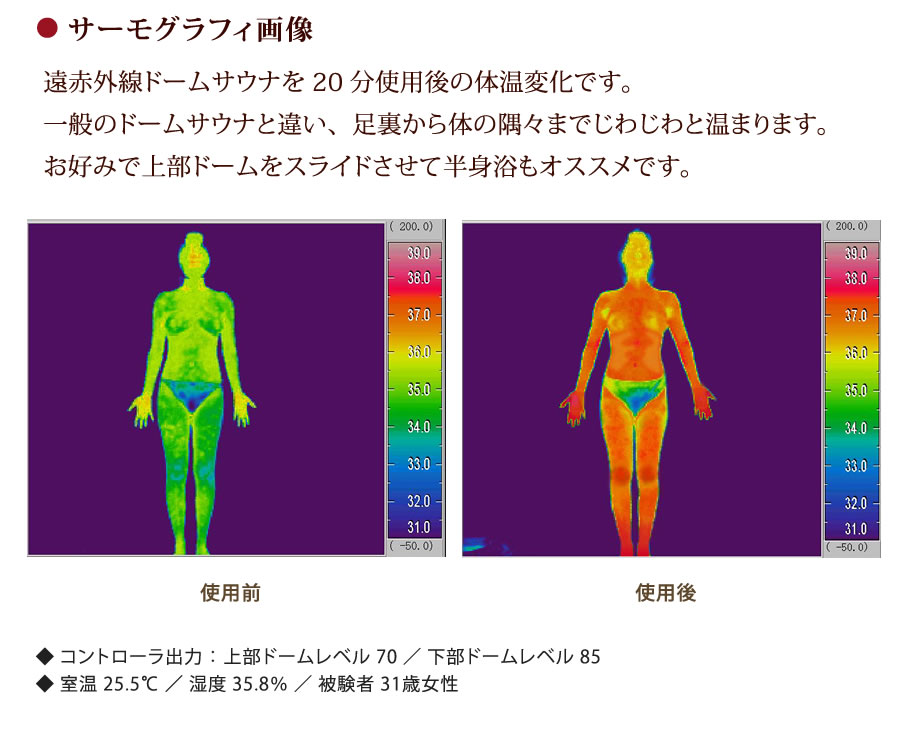 ● サーモグラフィ画像